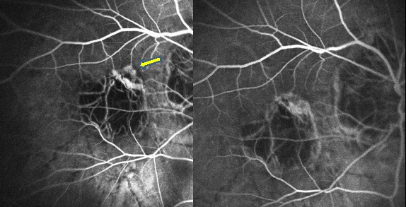 Fig.13